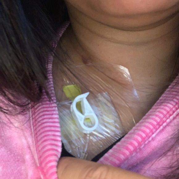 Health update - Picture 3 of 4